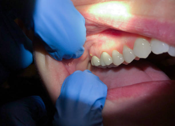 Best Emergency Dentist Near Me  in Yorktown, TX